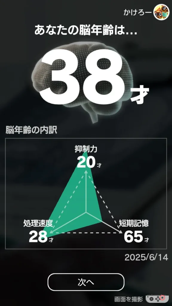 脳年齢38歳分布画像
